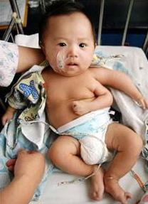 7 Gambar Manusia Dengan Bentuk Tubuh Teraneh Di Dunia 2