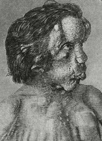 7 Gambar Manusia Dengan Bentuk Tubuh Teraneh Di Dunia 3