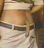 7 Gambar Manusia Dengan Bentuk Tubuh Teraneh Di Dunia 4