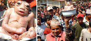 7 Gambar Manusia Dengan Bentuk Tubuh Teraneh Di Dunia 6