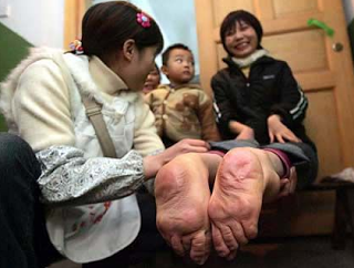 7 Gambar Manusia Dengan Bentuk Tubuh Teraneh Di Dunia